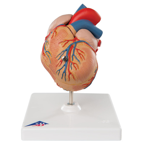 Anatomical Model- Classic Heart with Left Ventricular Hypertrophy (LVH), 2 part