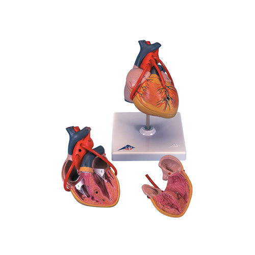Anatomical Models of Classic Heart with Bypass