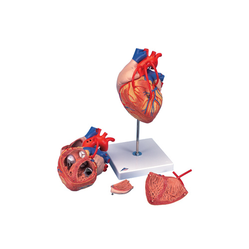 Anatomical Models about Heart with Bypass