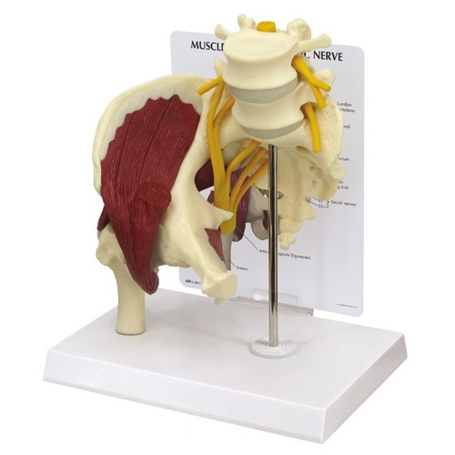 Anatomical Model- Muscled Hip with Sciatic Nerve