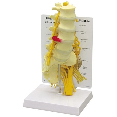 Anatomical Model- 5pc Vertebrae with sacrum