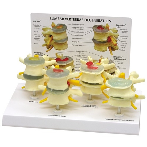 Anatomical Model- 4-Stage Vertebrae