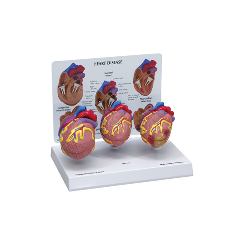 Anatomical Model- Mini Heart Set