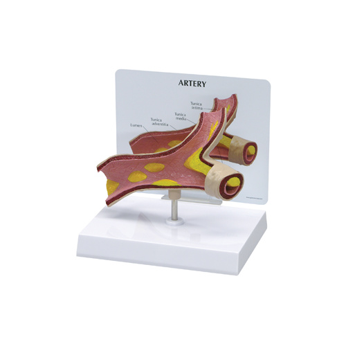 Anatomical Model- Artery