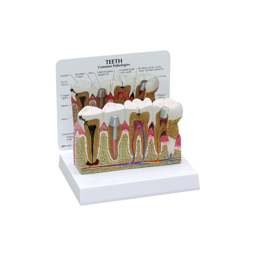 Anatomical Model- Teeth
