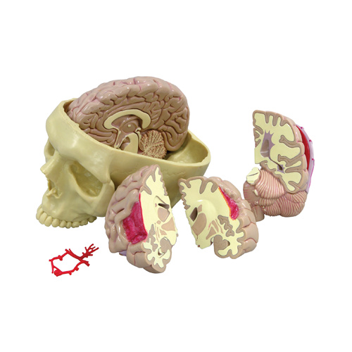 Anatomical Model- Brain
