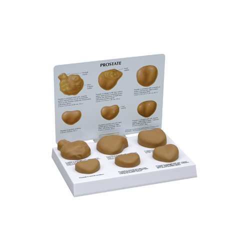 Anatomical Model- Prostate