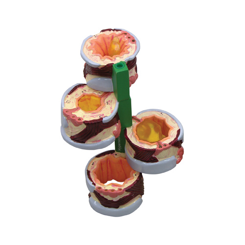 Anatomical Model- 4 Piece Bronchus
