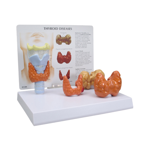 Anatomical Model -  Thyroid (4pt)