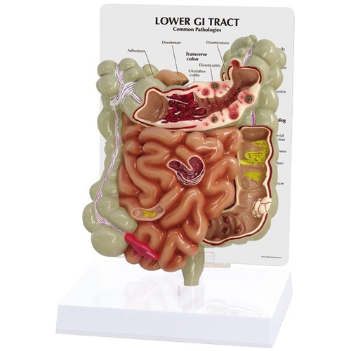 Anatomical Model - Colon And GI Tract