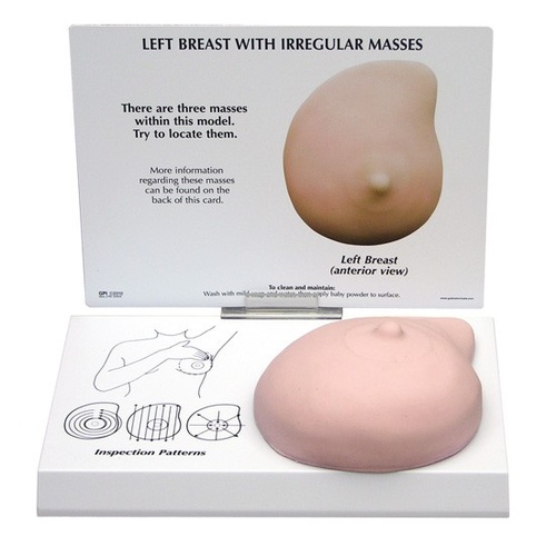 Breast Cancer