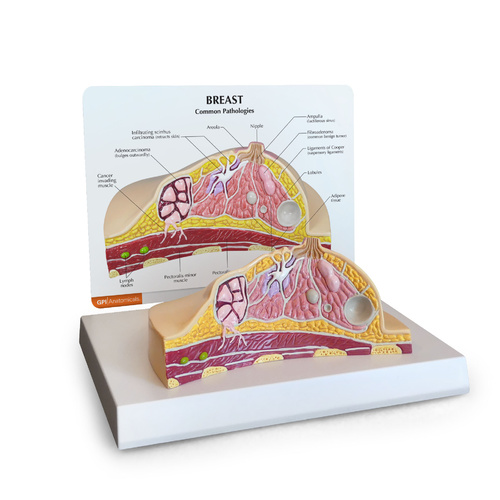 Anatomical Model- Breast Cross-section