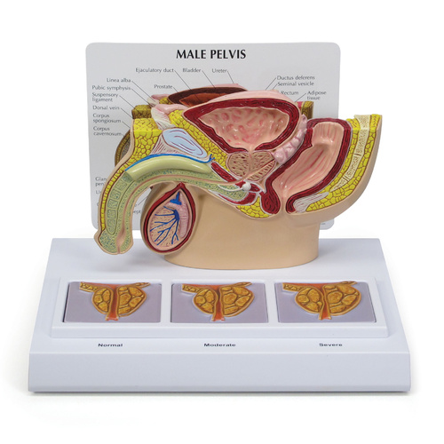 Anatomical Model- Male Pelvis with 3D Prostate