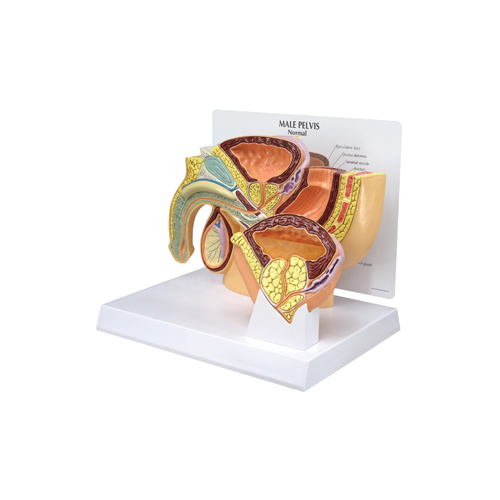 Anatomical Model- Male Pelvis with BPH