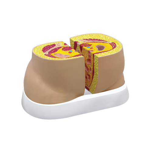 Anatomical Model- Obesity Model