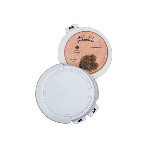 Anatomical Model- Skin Cancer Disk Set