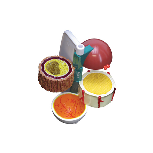 Anatomical Model-Diabetes Model Set (4pt)