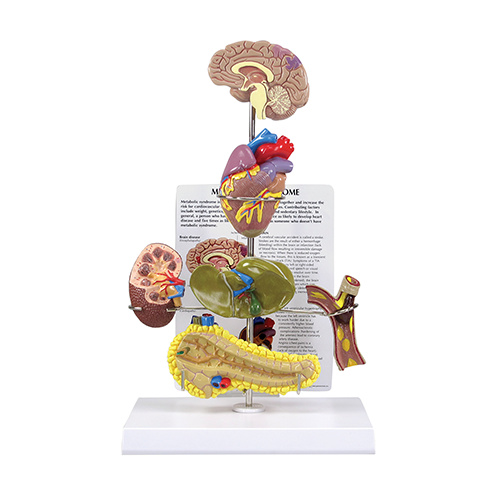 Anatomical Model-Metabolic Syndrome Models 
