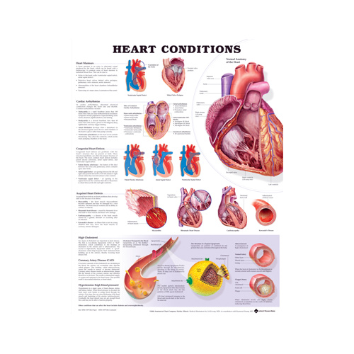 Anatomical Heart Conditions Chart