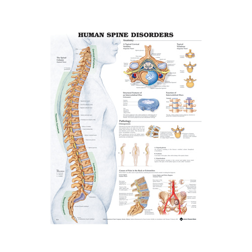 Human Spine Disorders Chart