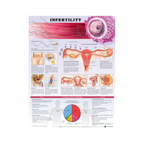 Anatomical Chart- Infertility
