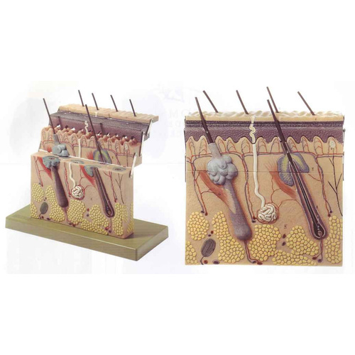 SECTION OF SKIN