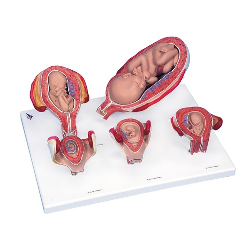 Anatomical Model-  Pregnancy Series 5 Models