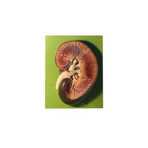 Somso Right Kidney Model