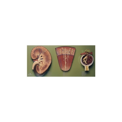 Kidney, Nephron and Glomerulus
