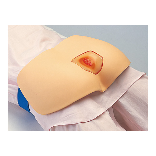 Sakamoto Decubitis Ulcer Management Simulator