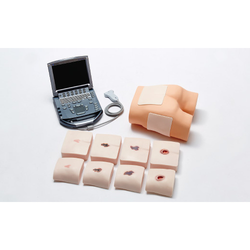Training Phantom for Ultrasonic Observation of Tissue Damage Portable Ultrasonography