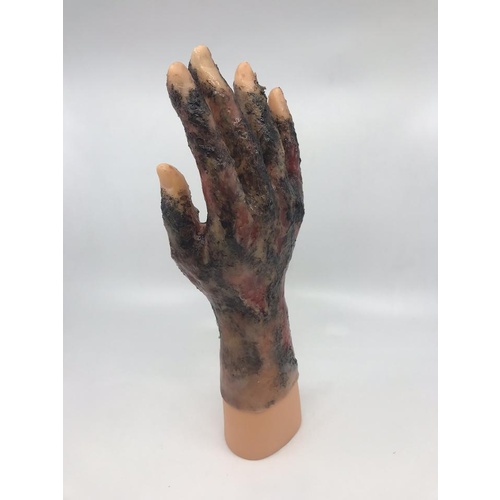 Glove Burned Hand