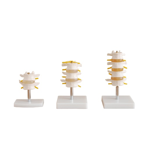 Anatomical Lumbar Set Model(4 pcs)