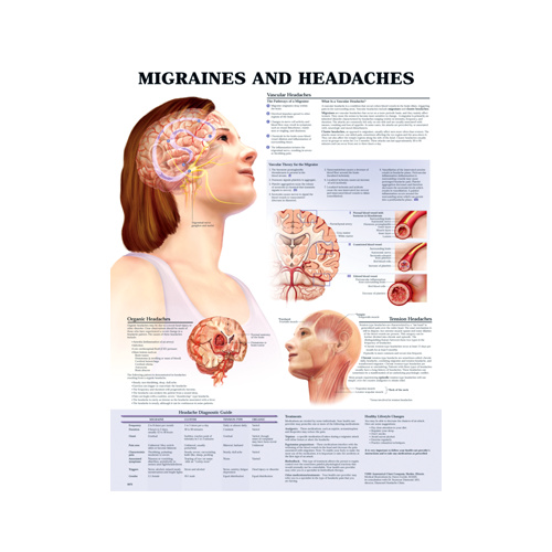 Cluster Headaches