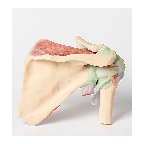  Anatomical Model- Shoulder Deep Dissection Of A Right Shoulder Girdle
