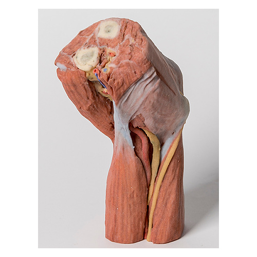 Anatomical Model Cubital Fossa Muscles Large Nerves And The Brachial Artery Anatomical Model Cubital Fossa Muscles Large Nerves And The Brachial Artery