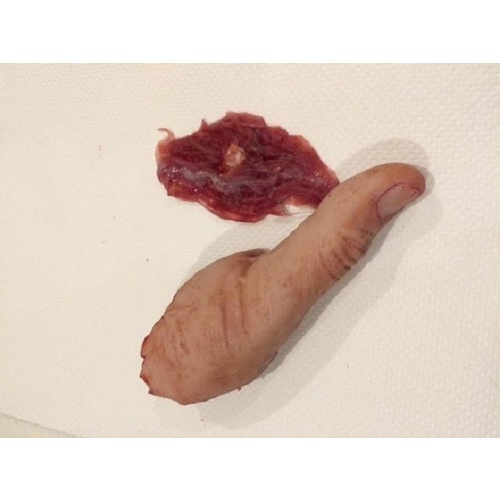 Severed Male Thumb with Attachment