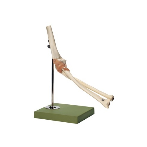 Functional Elbow Joint