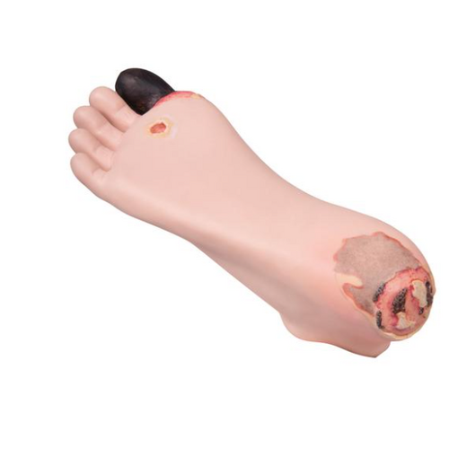 Decubitus Foot Treatment Trainer