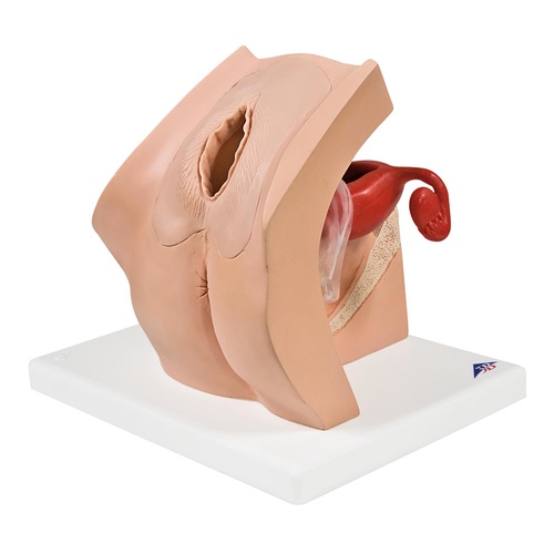 Model for Gynaecological Patient Education