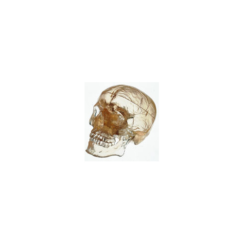 Somso Artificial Transparent Human Skull