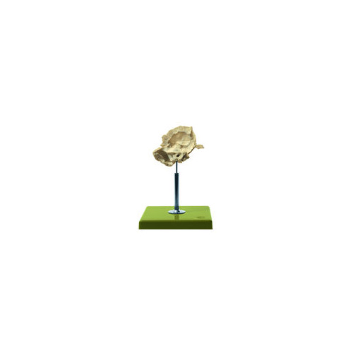 Artificial Temporal Bone