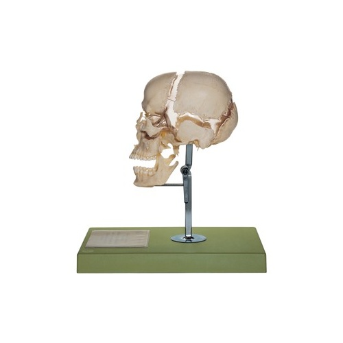 Artificial Bauchene Skull of an Adult