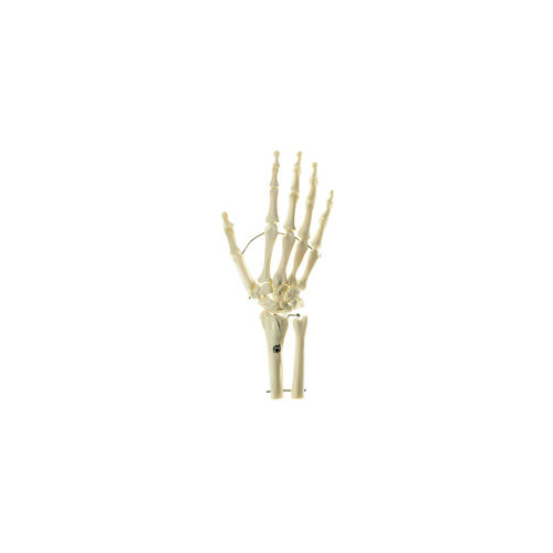 Somso Skeleton of the Hand with Base of Forearm