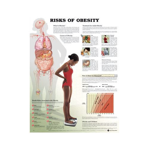 Anatomical Risks of Obesity Chart