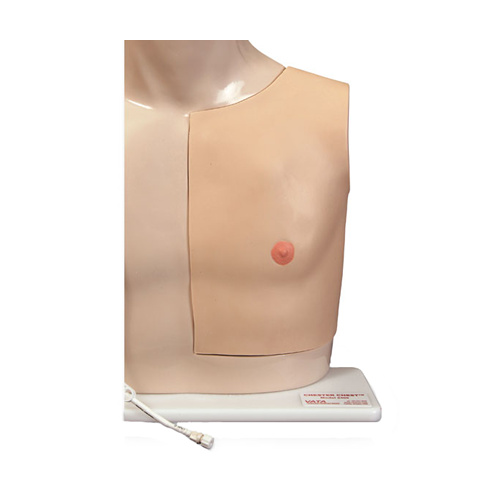 Chester Chest Tissue Replacement