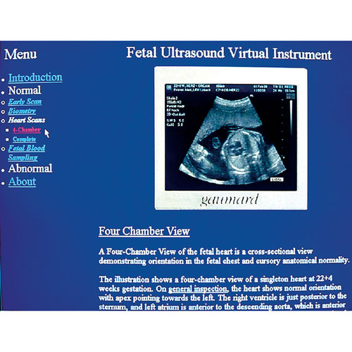 Gaumard NOELLE Ultrasounds CD-ROM