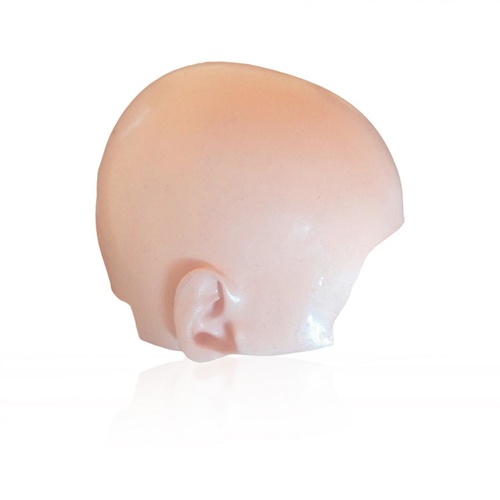 PHACON Neuro Patient “Becker” – Calvarium