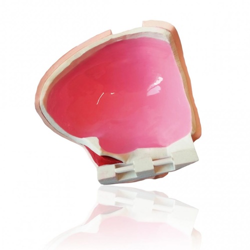 PHACON Neuro Patient “Becker”