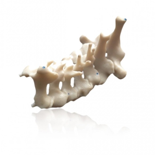 PHACON Cervical Spine Patient “Schubert” – Dorsal